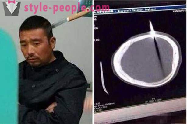 Kiinalainen mies veitsellä hänen päänsä hän meni lääkäriin