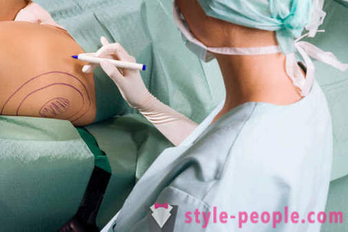 Plastiikkakirurgit tuhota stereotypioita työstään